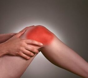 Symptome einer Arthrose des Kniegelenks
