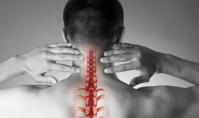 Ausgeprägte Schmerzen beim neurologischen Syndrom.