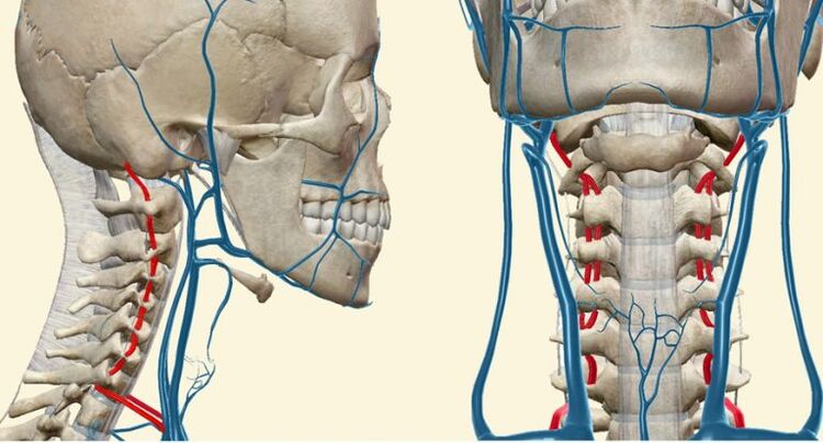 Gefäßsyndrom bei Osteochondrose.